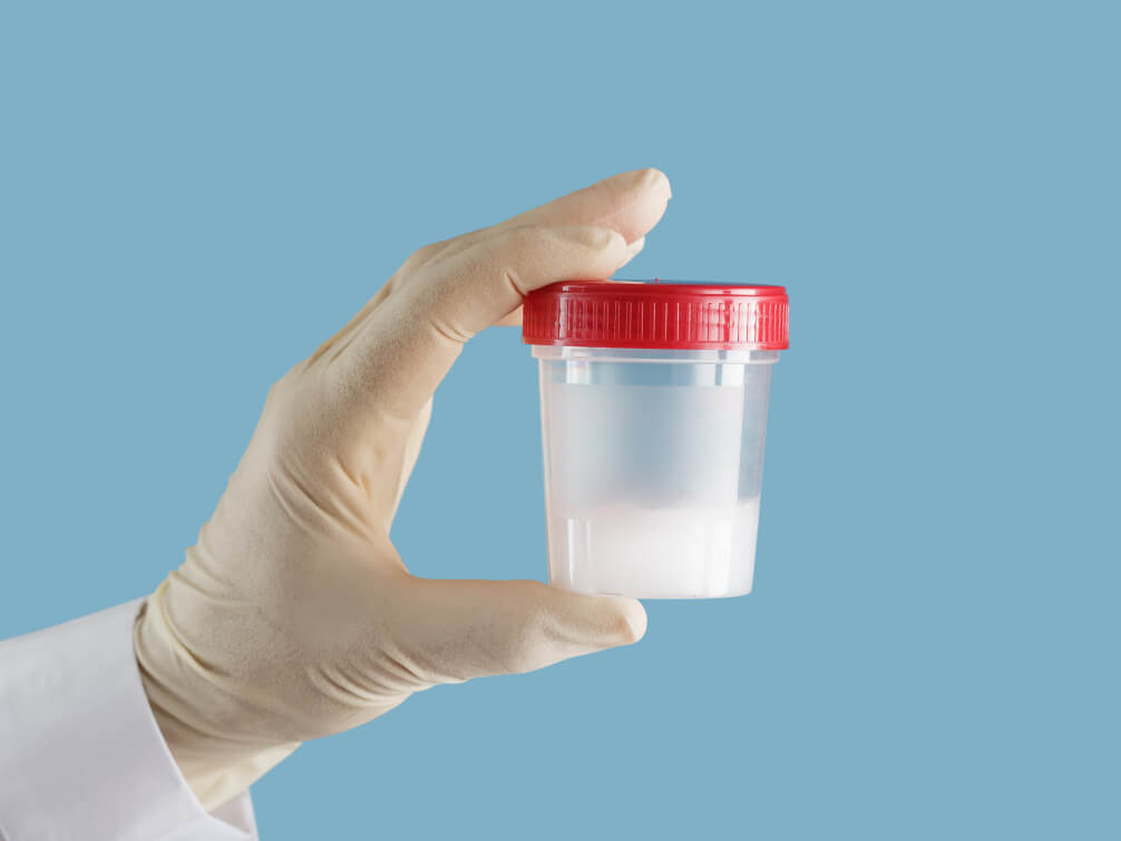 Secure Sperm Storage and Inventory Management in Delhi