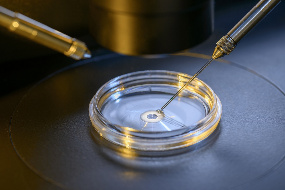 Donor Sperm Supply Services in Delhi