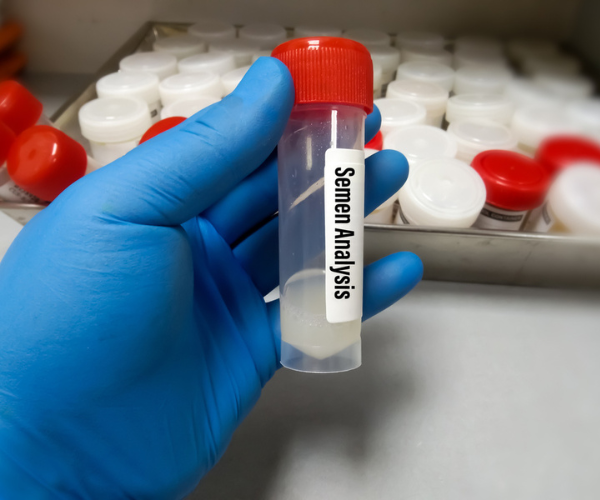 Semen Analysis Services in Delhi