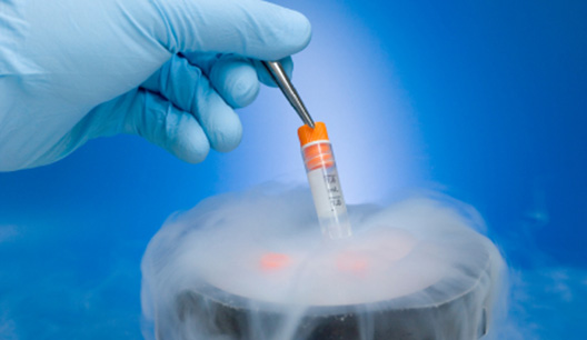 Sperm Freezing and Cryopreservation Services in Delhi